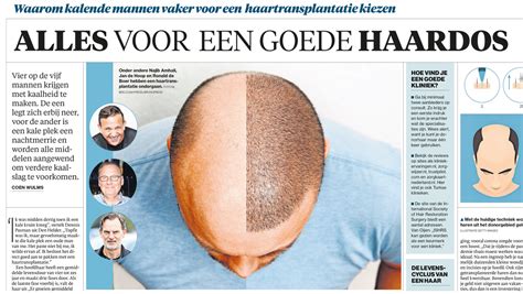 Waarom Haartransplantatie Een Goede Investering Is