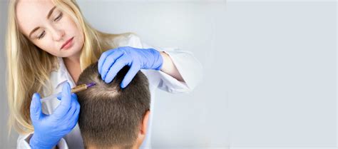 Haartransplantatie Technieken: Welke Is De Beste Voor Jou?